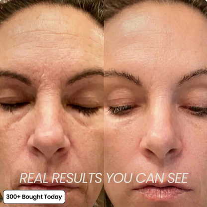 🔥 LAST DAY 50% OFF! Korean BellevorabeautyEye Cream for Dark Circles & Tired Eyes