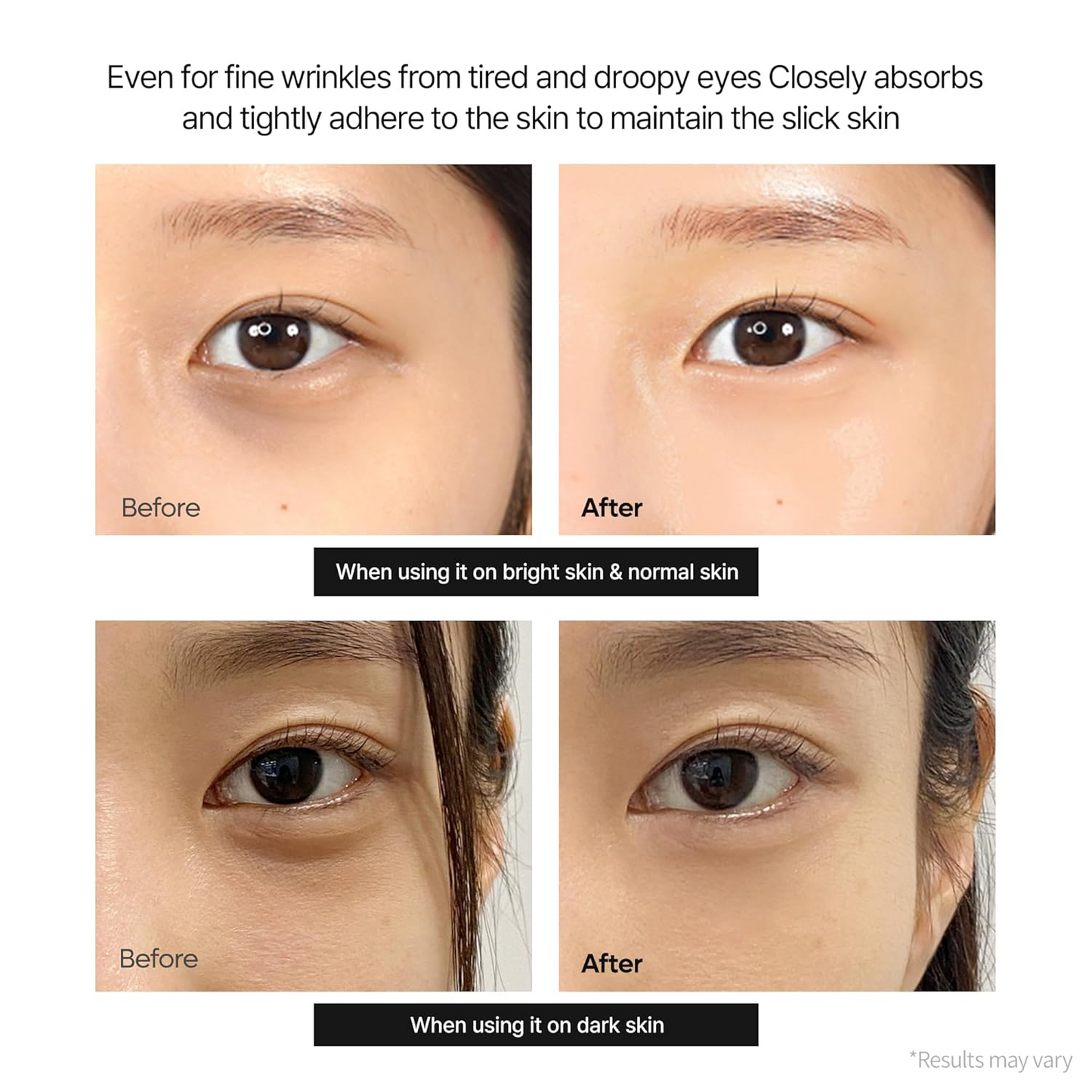 🔥 LAST DAY 50% OFF! Korean BellevorabeautyEye Cream for Dark Circles & Tired Eyes