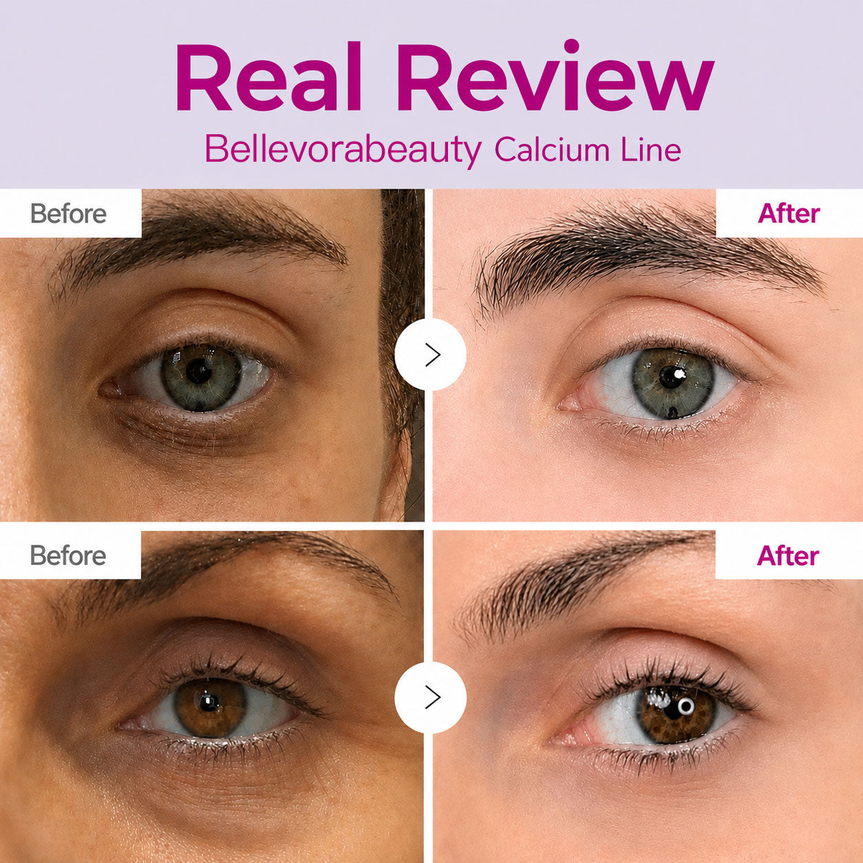 🔥 LAST DAY 50% OFF! Korean BellevorabeautyEye Cream for Dark Circles & Tired Eyes