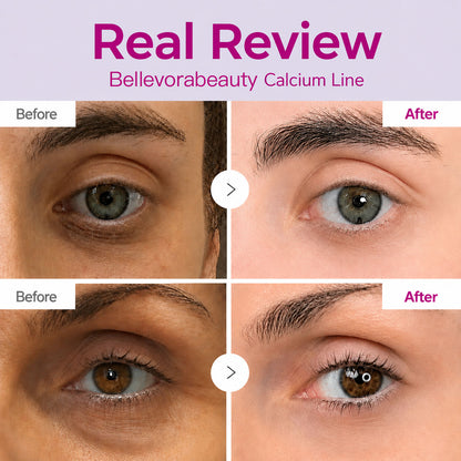 🔥 LAST DAY 50% OFF! Korean BellevorabeautyEye Cream for Dark Circles & Tired Eyes