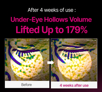 🔥 LAST DAY 50% OFF! Korean BellevorabeautyEye Cream for Dark Circles & Tired Eyes